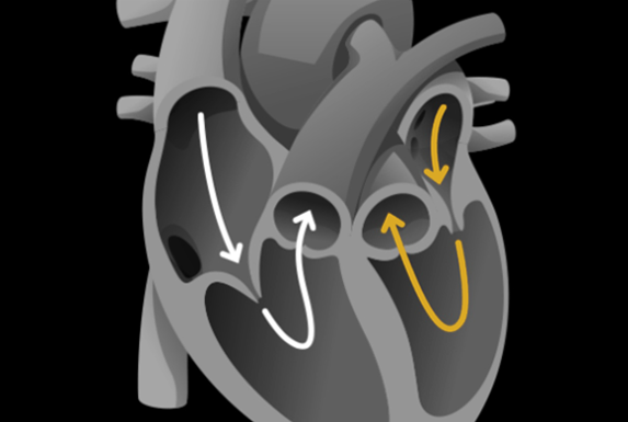 Tverrsnitt av et hjerte med piler som viser hvordan blodet flyter.